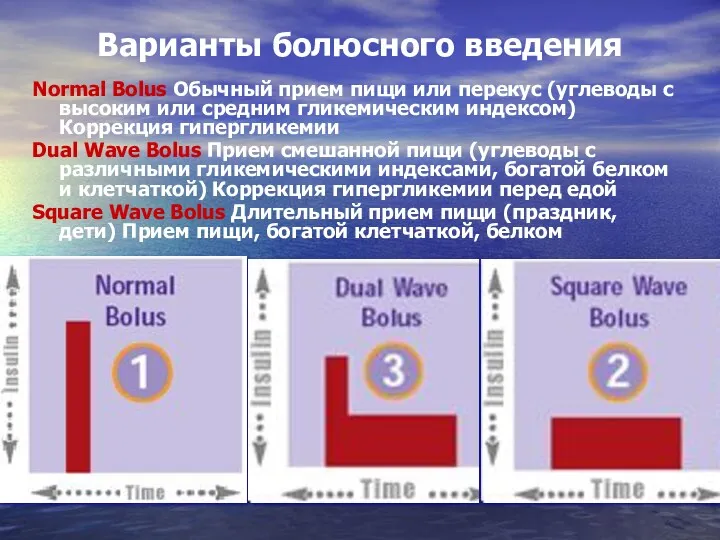 Варианты болюсного введения Normal Bolus Обычный прием пищи или перекус