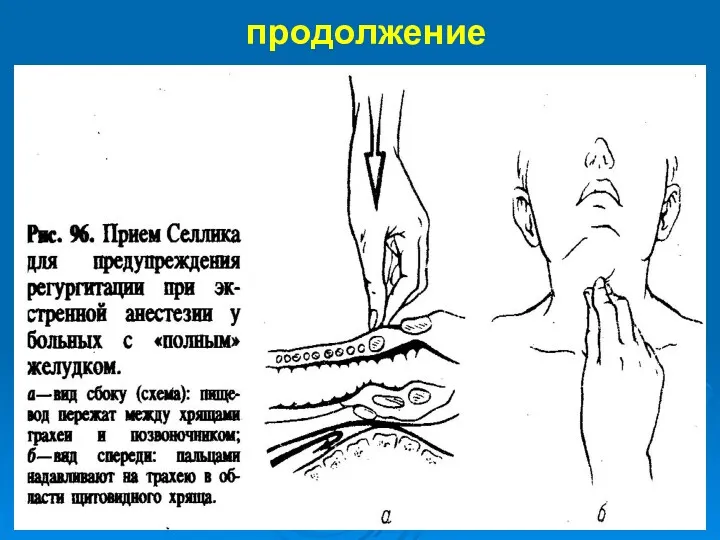 продолжение