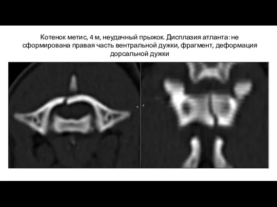 Котенок метис, 4 м, неудачный прыжок. Дисплазия атланта: не сформирована правая часть вентральной