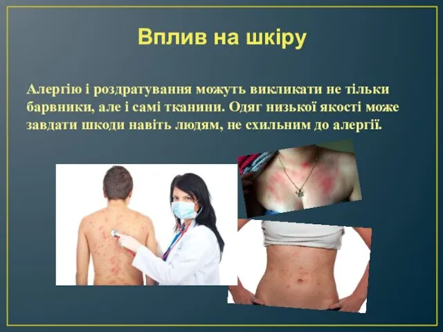 Вплив на шкіру Алергію і роздратування можуть викликати не тільки