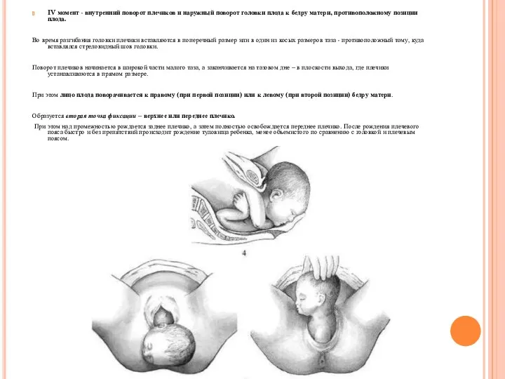 IV момент - внутренний поворот плечиков и наружный поворот головки