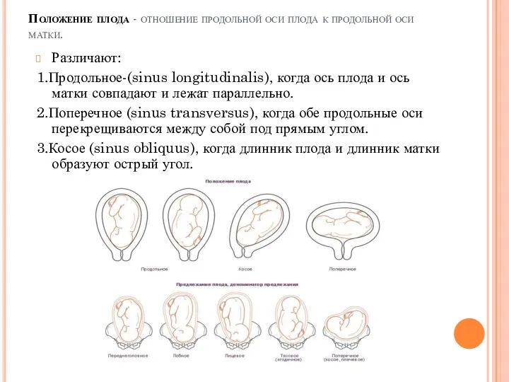 Положение плода - отношение продольной оси плода к продольной оси