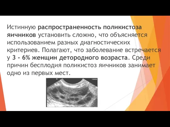 Истинную распространенность поликистоза яичников установить сложно, что объясняется использованием разных