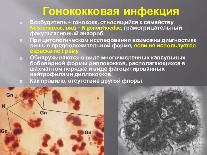 Гонококковая инфекция Возбудитель – гонококк, относящийся к семейству Neisseriaceae, вид