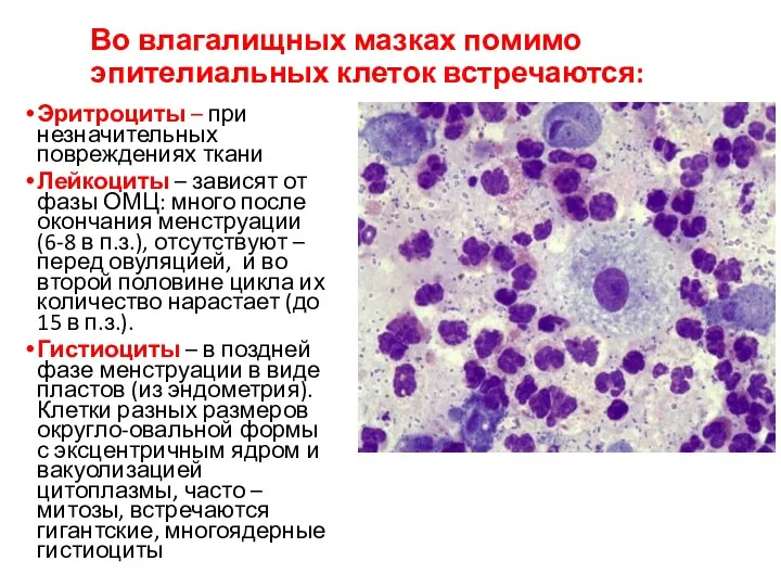 Во влагалищных мазках помимо эпителиальных клеток встречаются: Эритроциты – при