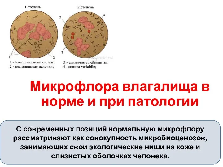 Микрофлора влагалища в норме и при патологии С современных позиций