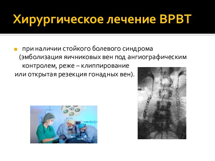 Хирургическое лечение ВРВТ при наличии стойкого болевого синдрома (эмболизация яичниковых