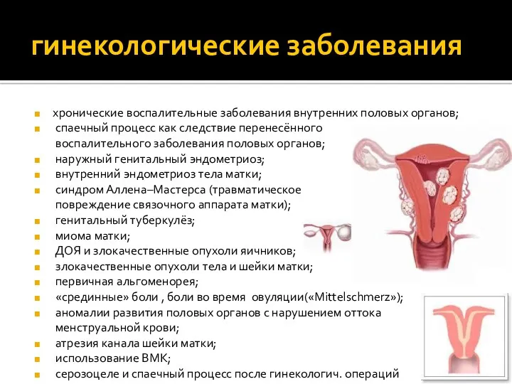 гинекологические заболевания хронические воспалительные заболевания внутренних половых органов; спаечный процесс