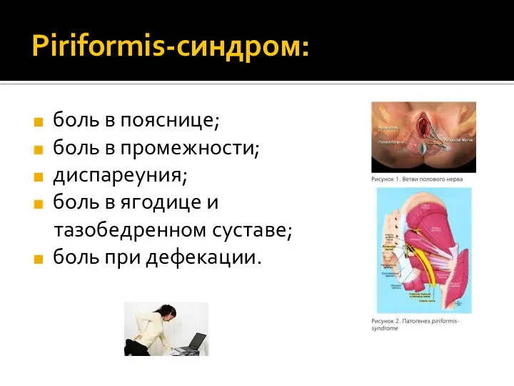 Piriformis-синдром: боль в пояснице; боль в промежности; диспареуния; боль в