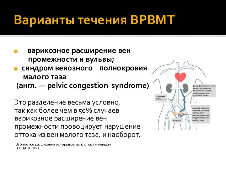 Варианты течения ВРВМТ варикозное расширение вен промежности и вульвы; синдром