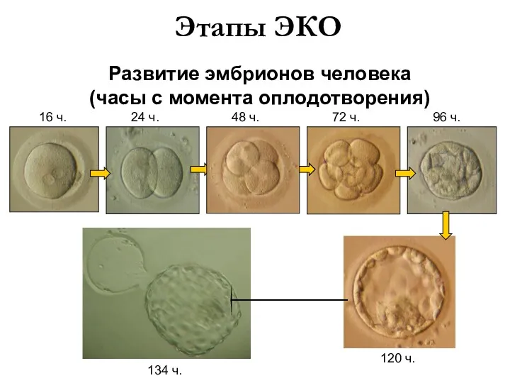 Развитие эмбрионов человека (часы с момента оплодотворения) ЕТ ЕТ Этапы ЭКО