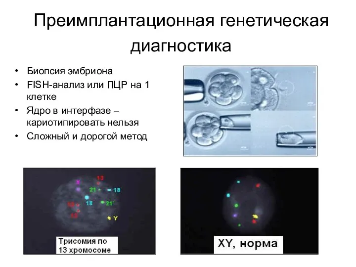 Преимплантационная генетическая диагностика Биопсия эмбриона FISH-анализ или ПЦР на 1