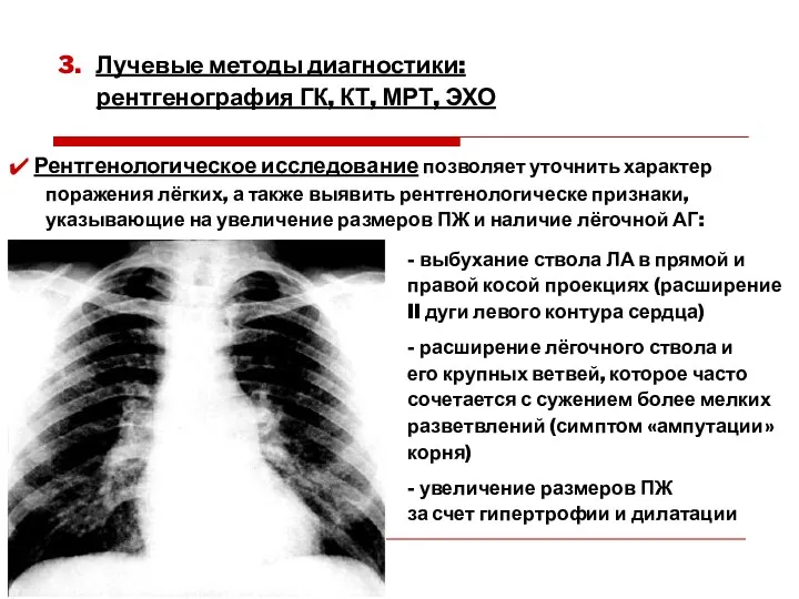 3. Лучевые методы диагностики: рентгенография ГК, КТ, МРТ, ЭХО -