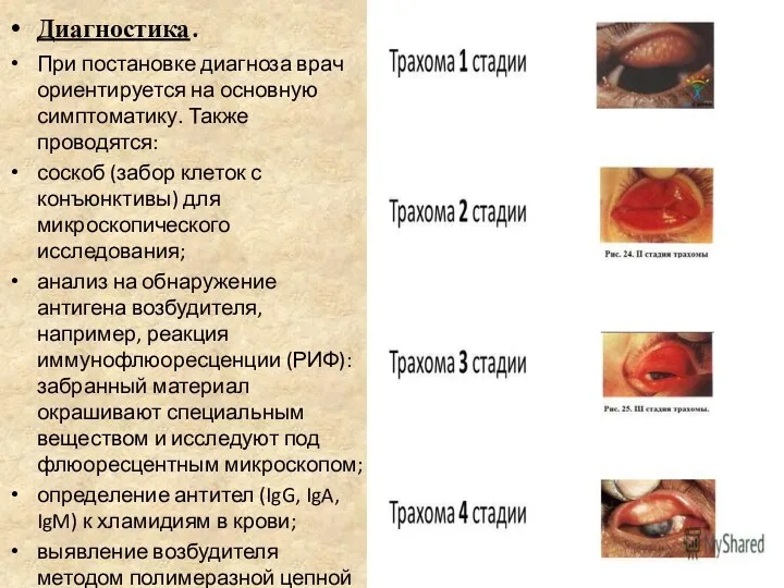 Диагностика. При постановке диагноза врач ориентируется на основную симптоматику. Также