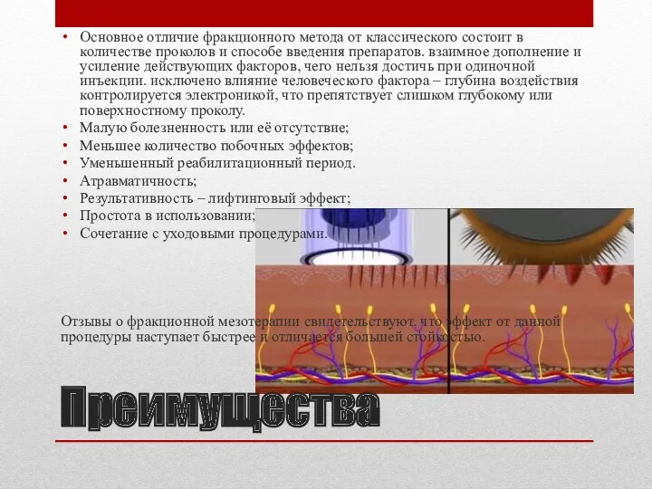 Преимущества Основное отличие фракционного метода от классического состоит в количестве