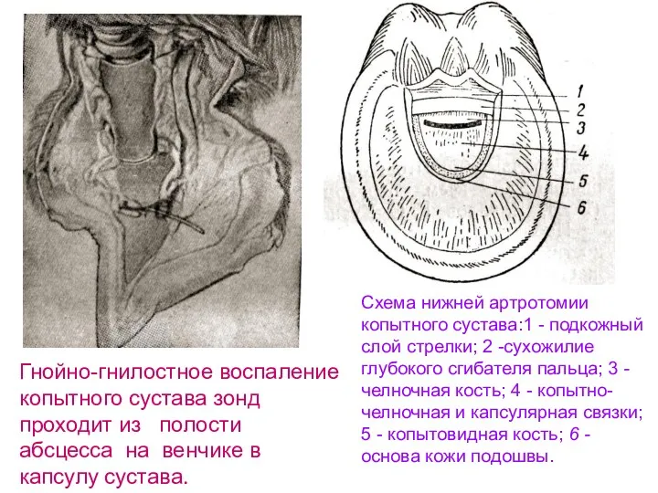 Гнойно-гнилостное воспаление копытного сустава зонд проходит из полости абсцесса на венчике в капсулу