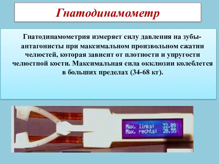 Гнатодинамометр Гнатодинамометрия измеряет силу давления на зубы-антагонисты при максимальном произвольном