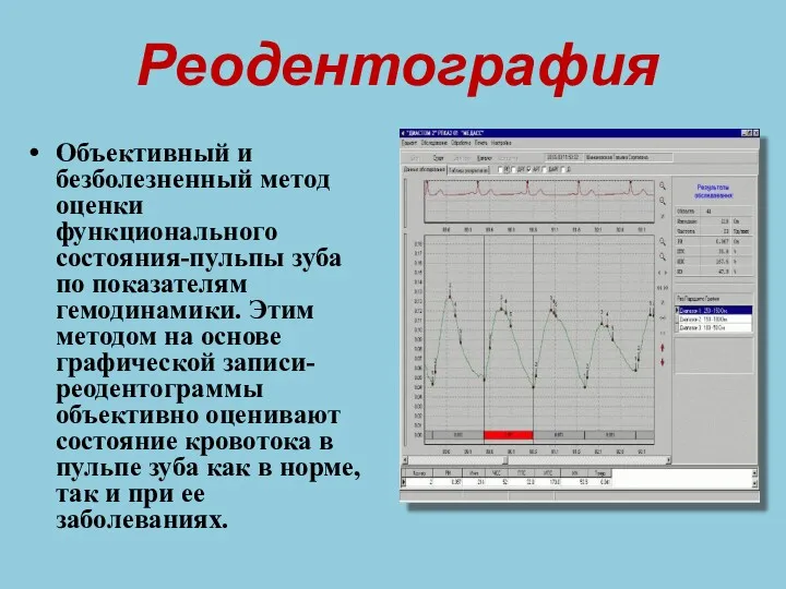 Реодентография Объективный и безболезненный метод оценки функционального состояния-пульпы зуба по