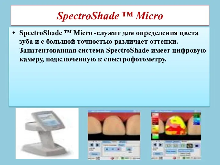 SpectroShade ™ Micro SpectroShade ™ Micro -служит для определения цвета