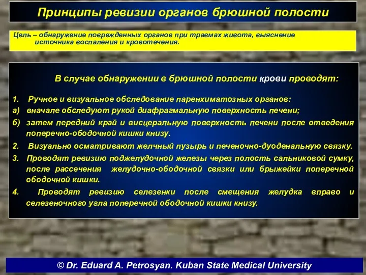 Принципы ревизии органов брюшной полости В случае обнаружении в брюшной