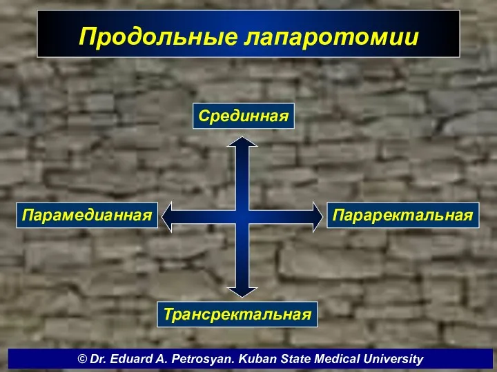 Продольные лапаротомии Срединная Парамедианная Трансректальная Параректальная © Dr. Eduard A. Petrosyan. Kuban State Medical University
