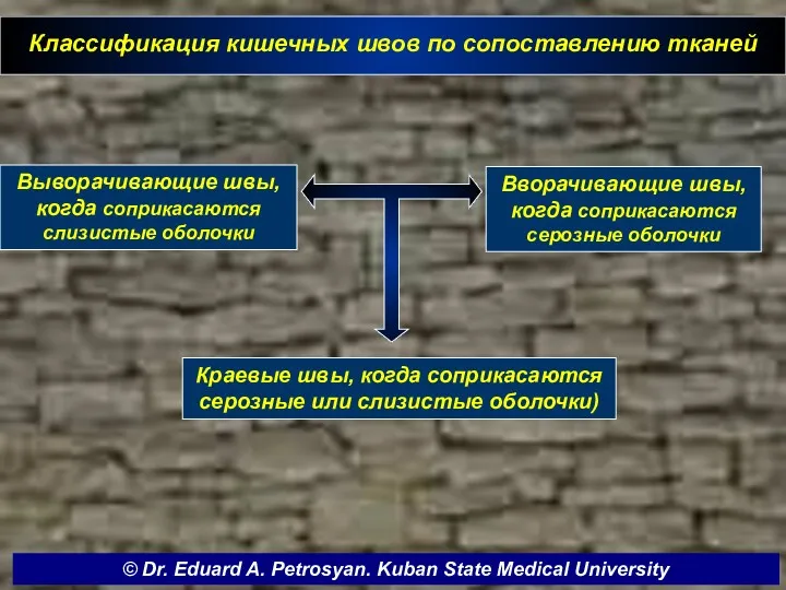 Классификация кишечных швов по сопоставлению тканей Краевые швы, когда соприкасаются