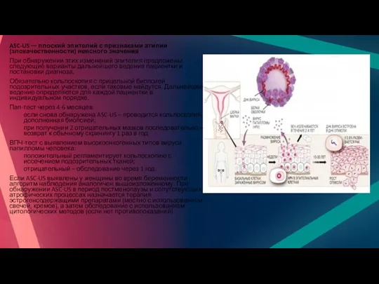 ASC-US — плоский эпителий с признаками атипии (злокачественности) неясного значения