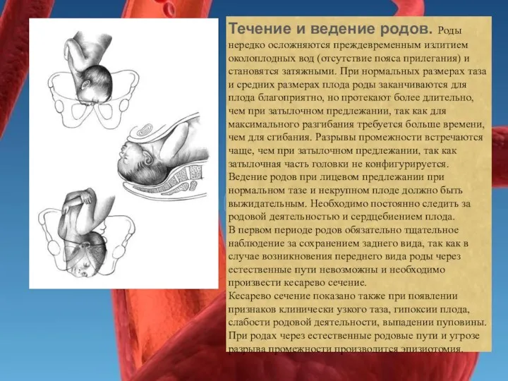 Течение и ведение родов. Роды нередко осложняются преждевременным излитием околоплодных