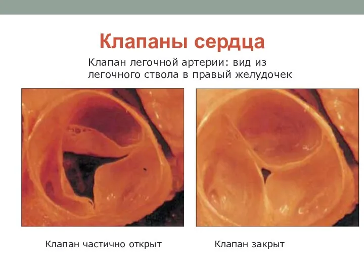 Клапаны сердца Клапан легочной артерии: вид из легочного ствола в