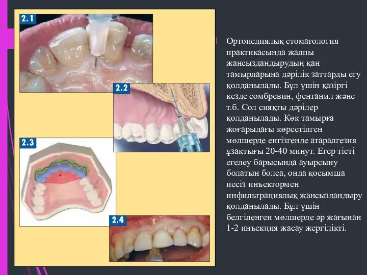 Ортопедиялық стоматология практикасында жалпы жансыздандырудың қан тамырларына дәрілік заттарды егу
