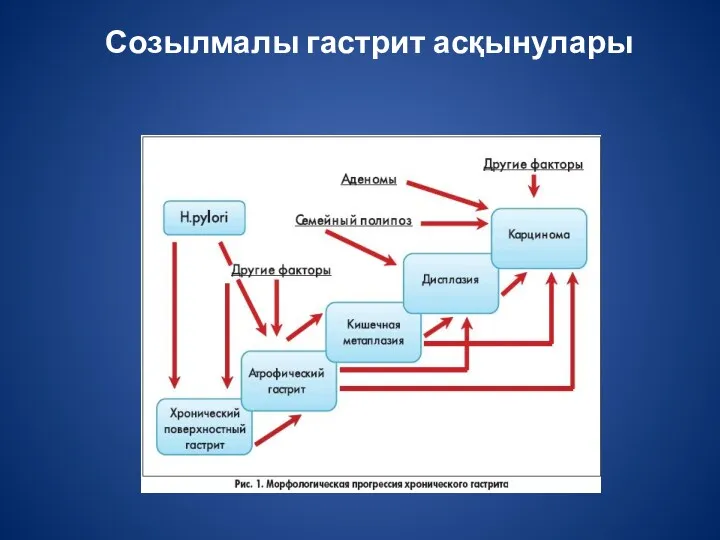 Созылмалы гастрит асқынулары