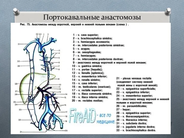 Портокавальные анастомозы