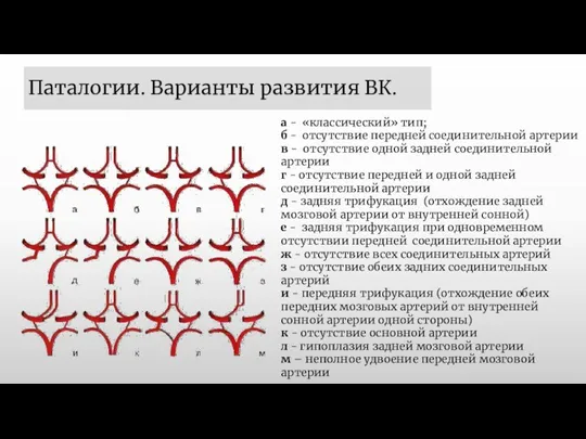 Паталогии. Варианты развития ВК. а - «классический» тип; б -