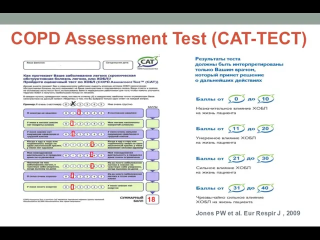 COPD Assessment Test (CAT-ТЕСТ) Jones PW et al. Eur Respir