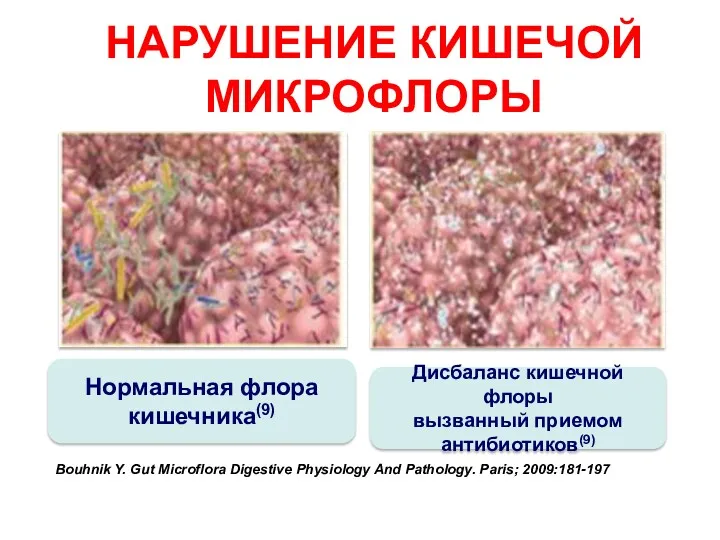 НАРУШЕНИЕ КИШЕЧОЙ МИКРОФЛОРЫ Нормальная флора кишечника(9) Дисбаланс кишечной флоры вызванный