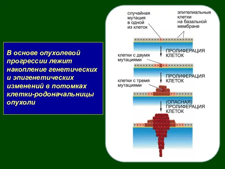 В основе опухолевой прогрессии лежит накопление генетических и эпигенетических изменений в потомках клетки-родоначальницы опухоли