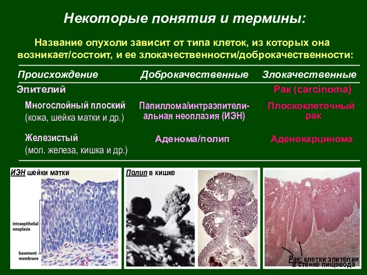 Название опухоли зависит от типа клеток, из которых она возникает/состоит,