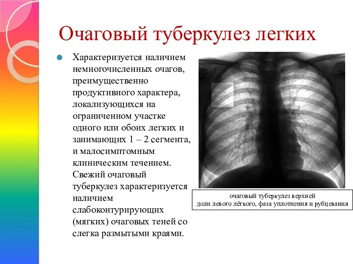 Очаговый туберкулез легких Характеризуется наличием немногочисленных очагов, преимущественно продуктивного характера, локализующихся на ограниченном