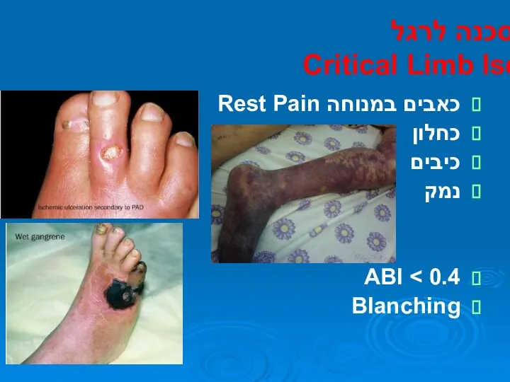 סכנה לרגל Critical Limb Ischemia כאבים במנוחה Rest Pain כחלון כיבים נמק ABI Blanching