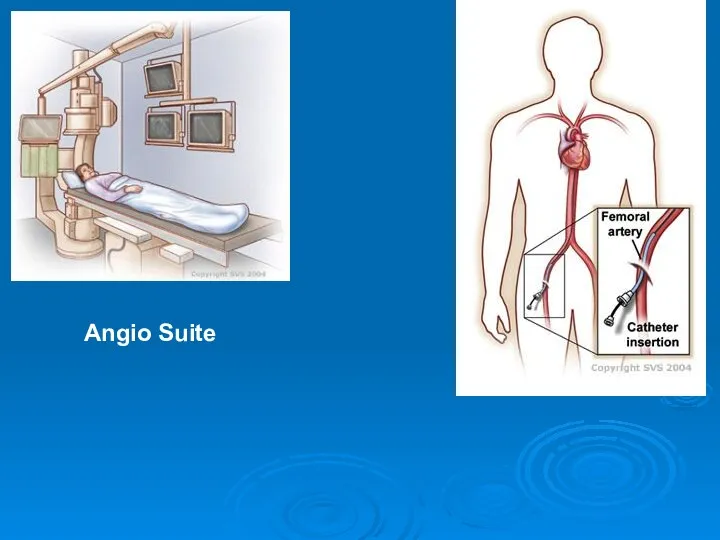 Angio Suite