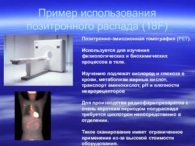 Пример использования позитронного распада (18F)‏ Позитронно-эмиссионная томография (PET). Используется для