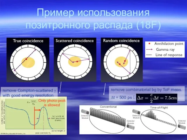 Пример использования позитронного распада (18F)‏ remove Compton-scattered γ with good