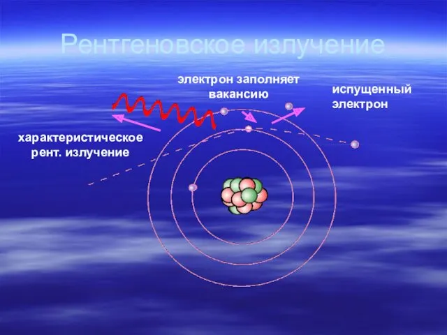 Рентгеновское излучение