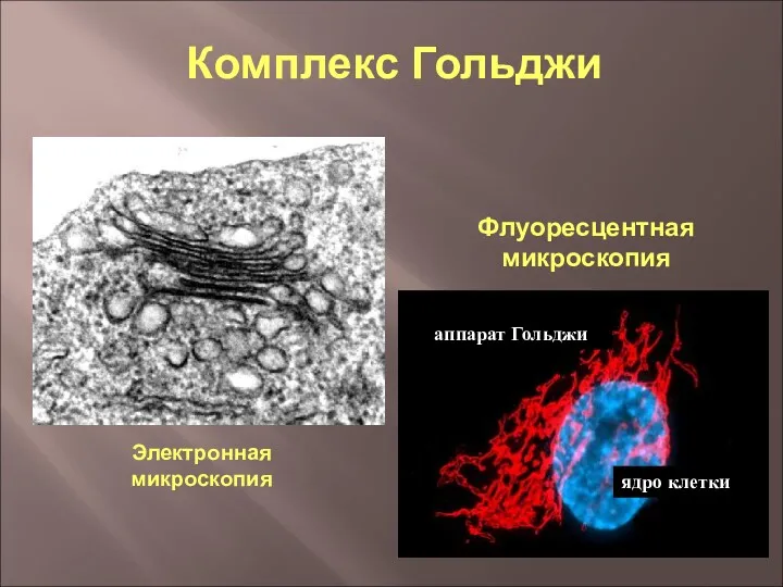 Электронная микроскопия Флуоресцентная микроскопия ядро клетки аппарат Гольджи Комплекс Гольджи
