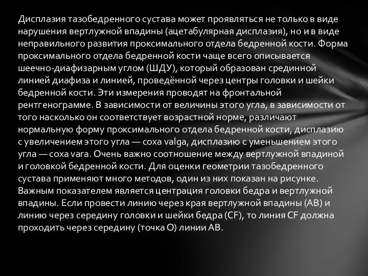 Дисплазия тазобедренного сустава может проявляться не только в виде нарушения