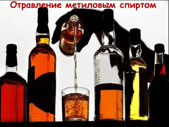 Отравление метиловым спиртом