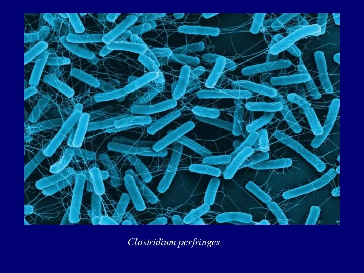 Clostridium perfringes