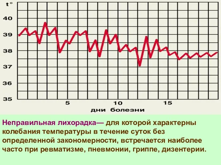 Неправильная лихорадка— для которой характерны колебания температуры в течение суток