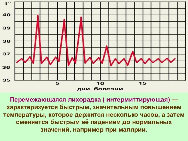 Перемежающаяся лихорадка ( интермиттирующая) — характеризуется быстрым, значительным повышением температуры,