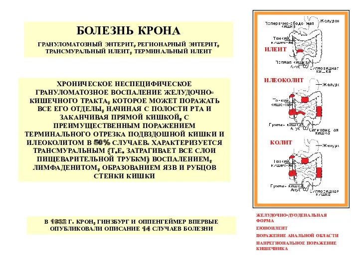 БОЛЕЗНЬ КРОНА ГРАНУЛОМАТОЗНЫЙ ЭНТЕРИТ, РЕГИОНАРНЫЙ ЭНТЕРИТ, ТРАНСМУРАЛЬНЫЙ ИЛЕИТ, ТЕРМИНАЛЬНЫЙ ИЛЕИТ